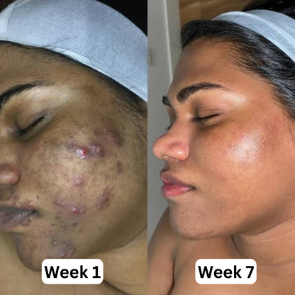 Nude Nectar | Brighten & Tone Kit