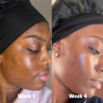 Nude Nectar | Brighten & Tone Kit