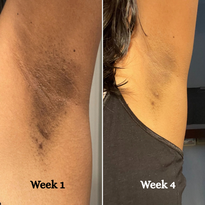 Nude Nectar | Brighten & Tone Kit