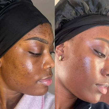 Kojic Soap Dark Spot Correction Bar (2 Bars)