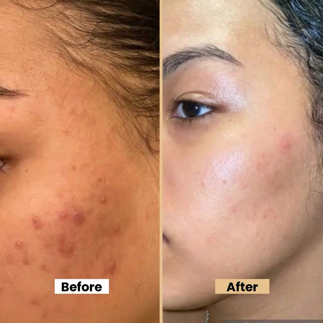 Nude Nectar | Brighten & Tone Kit